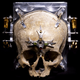 Illustration for article titled Eerie photographs taken with a camera made from a human skull
